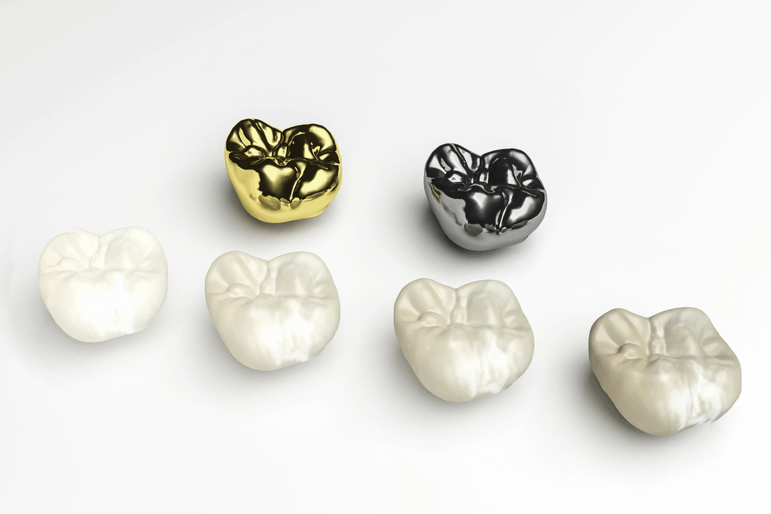 What Are The Benefits Of Getting a Dental Crown?