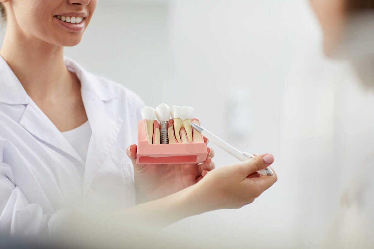 Why are Dental Implants Best for Replacing Missing Teeth?