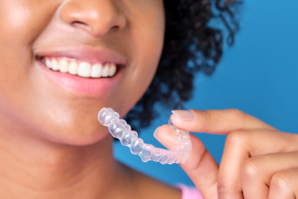 Invisalign in Vancouver