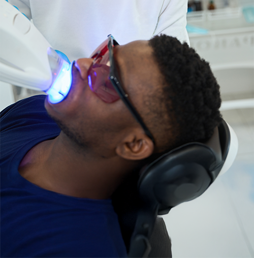 Professional Teeth Whitening in Vancouver