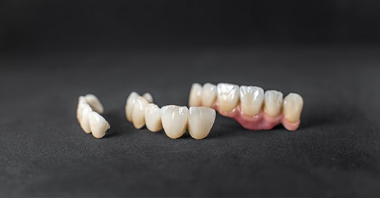 Dental Crowns in Vancouver | Regain Your Smile ✅