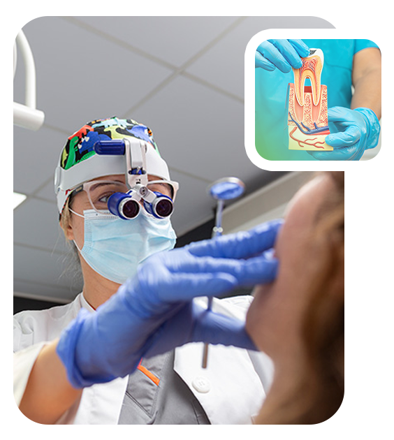 root-canals-masset root canals